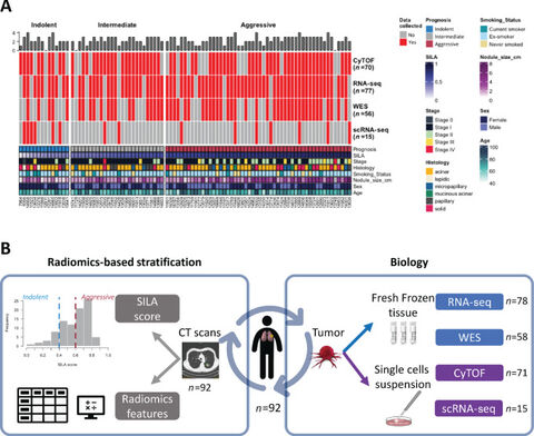 Figure from: Integrated multi-omics analysis of early lung adenocarcinoma links tumor biological features with predicted indolence or aggressiveness